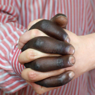 Hand in Hand. Gefaltete Hände. Eine Hand hat dunkle die andere helle Haut.